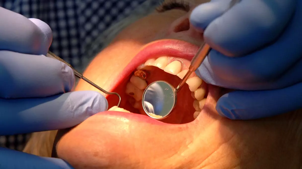 nottingham universitesinden dis minesini onaran yeni jel mKpPfMDh.jpg